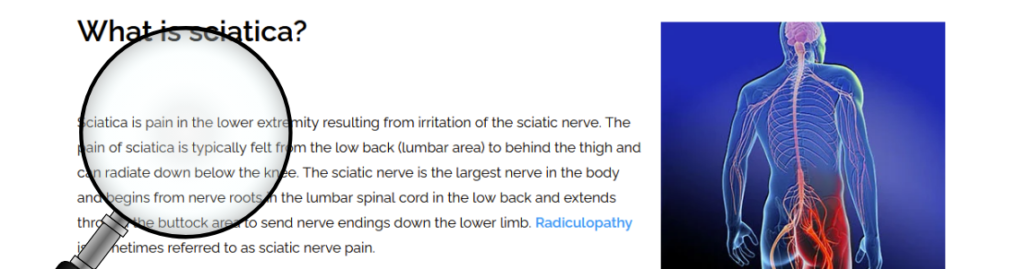 what is sciatica