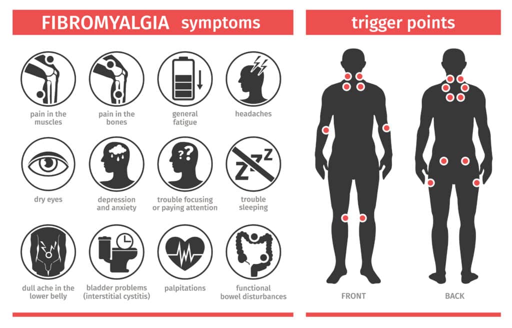 Symptoms and signs of fibromyalgia